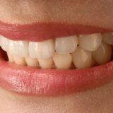 歯並びが悪くなる原因は？悪化を防ぐ4つの方法