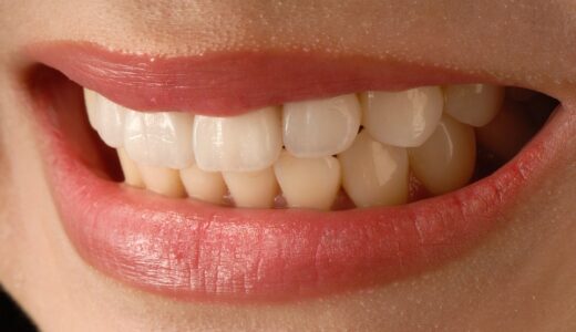 歯並びが悪くなる原因は？悪化を防ぐ4つの方法-パート2-