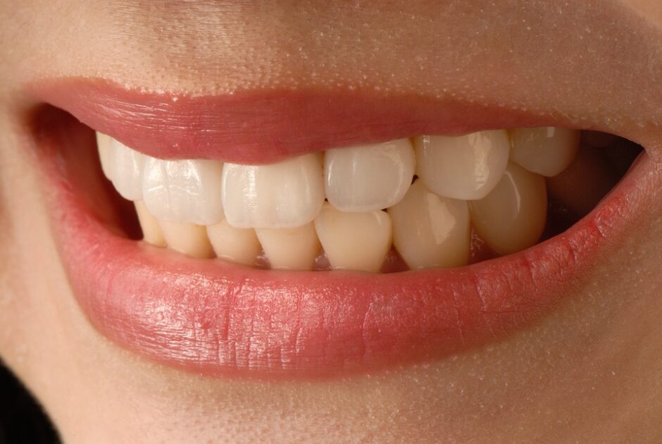 歯並びが悪くなる原因は？悪化を防ぐ4つの方法