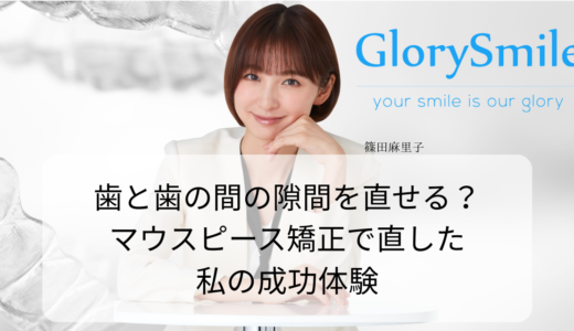 歯と歯の間の隙間を直せる？マウスピース矯正で直した私の成功体験